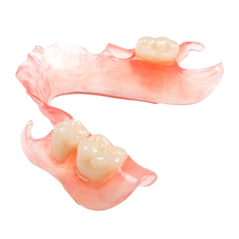 Съемный протез зубов какие бывают. Нейлоновый микропротез 1-3 зуба. Нейлоновый микропротез бабочка. Частичный иммедиат протез. Нейлоновый иммедиат протез.